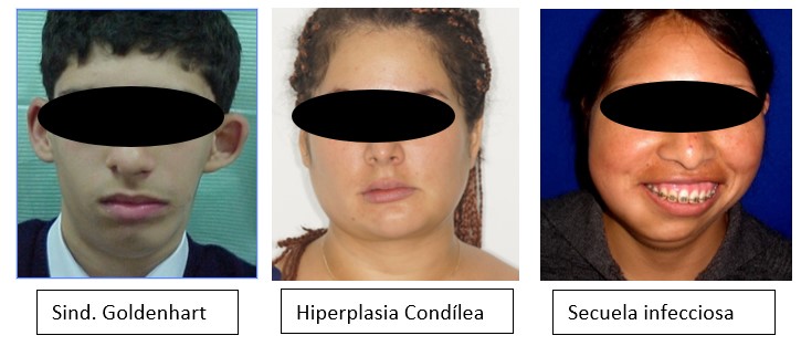 asimetricas_facial_1