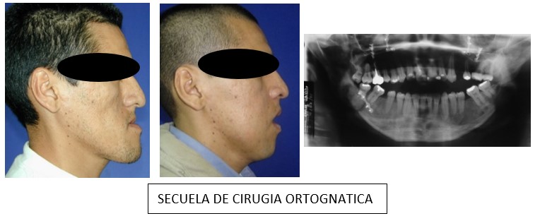 asimetricas_facial_2